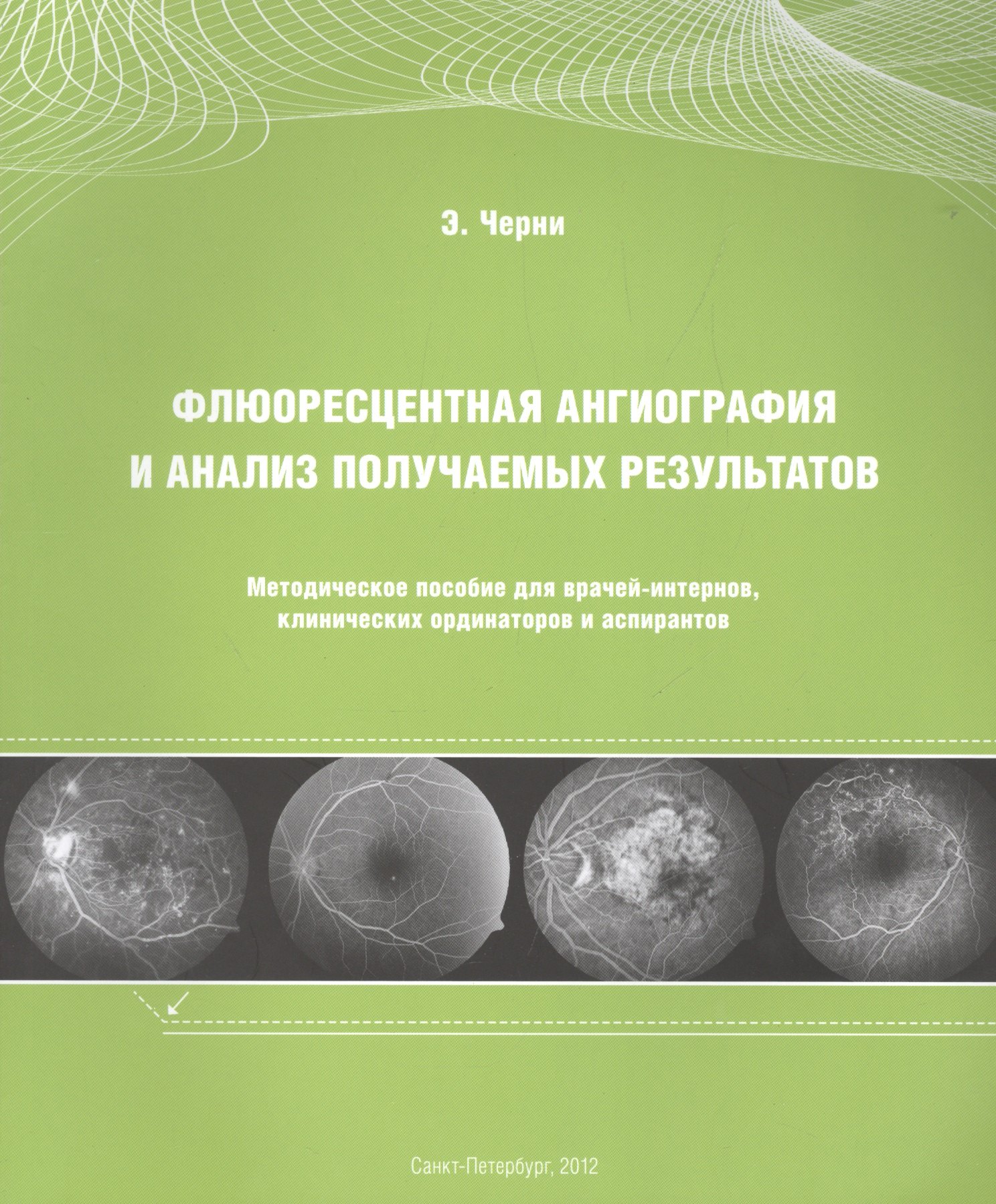 Флюоресцентная ангиография и анализ получаемых результатов: Методическое пособие для врачей-интернов, клинических ординаторов и аспирантов
Флюоресцентная ангиография и анализ получаемых результатов: Методическое пособие для врачей-интернов, клинических ординаторов и аспирантов