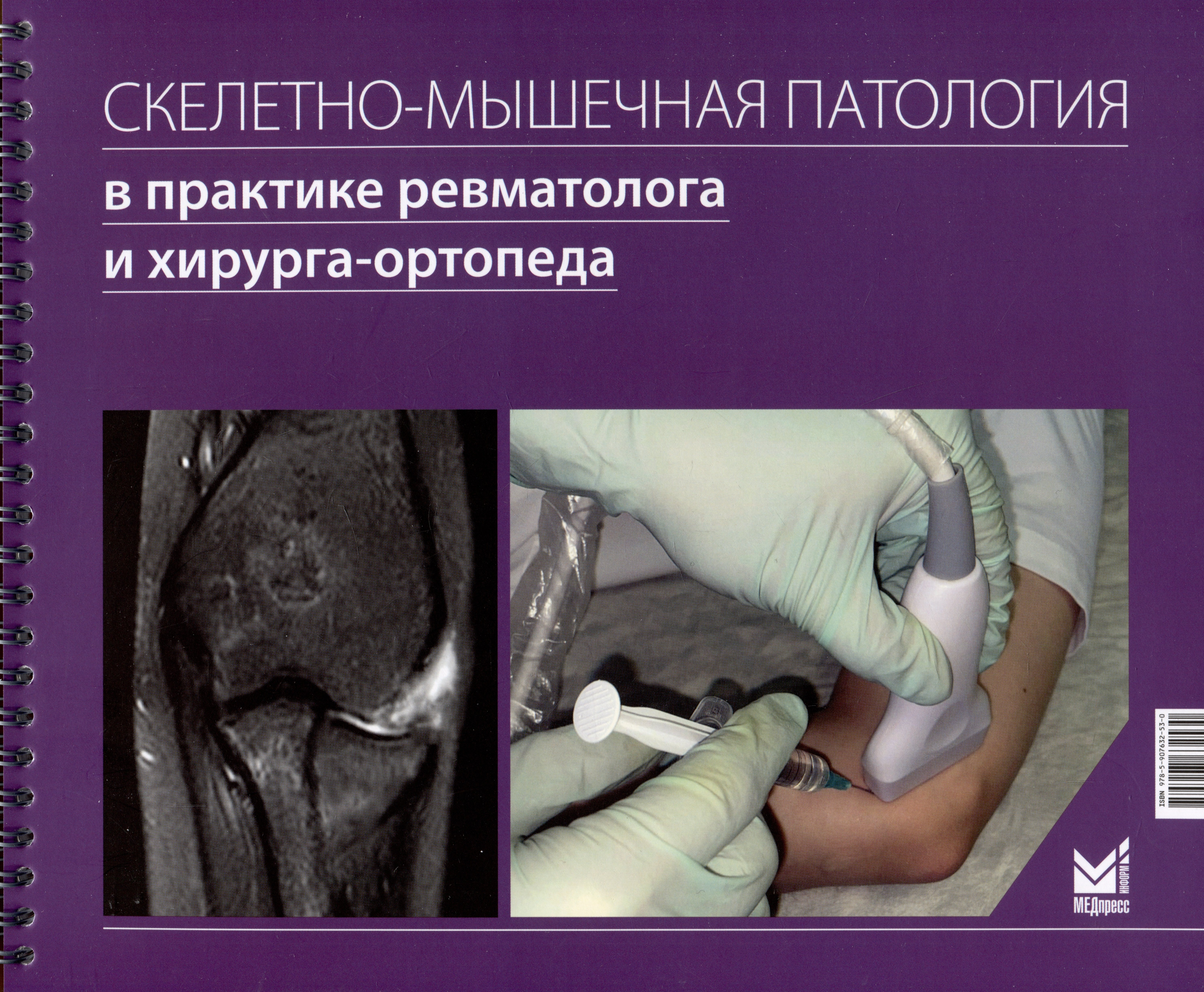 Скелетно-мышечная патология в практике ревматолога и хирурга-ортопеда:Краткое иллюстрированное руководство
Скелетно-мышечная патология в практике ревматолога и хирурга-ортопеда:Краткое иллюстрированное руководство