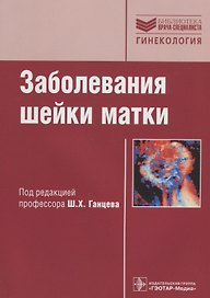 Заболевания шейки матки: руководство
