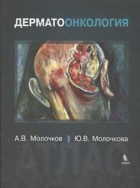 Дерматоонкология. Атлас