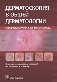 Дерматоскопия в общей дерматологии