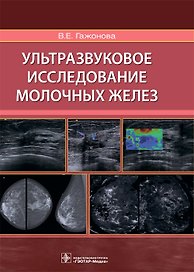 Ультразвуковое исследование молочных желез