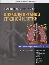 Лучевая диагностика. Опухоли органов грудной клетки