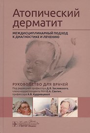 Атопический дерматит. Междисциплинарный подход к диагностике и лечению. Руководство для врачей