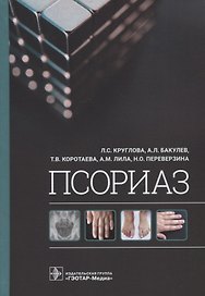 Псориаз