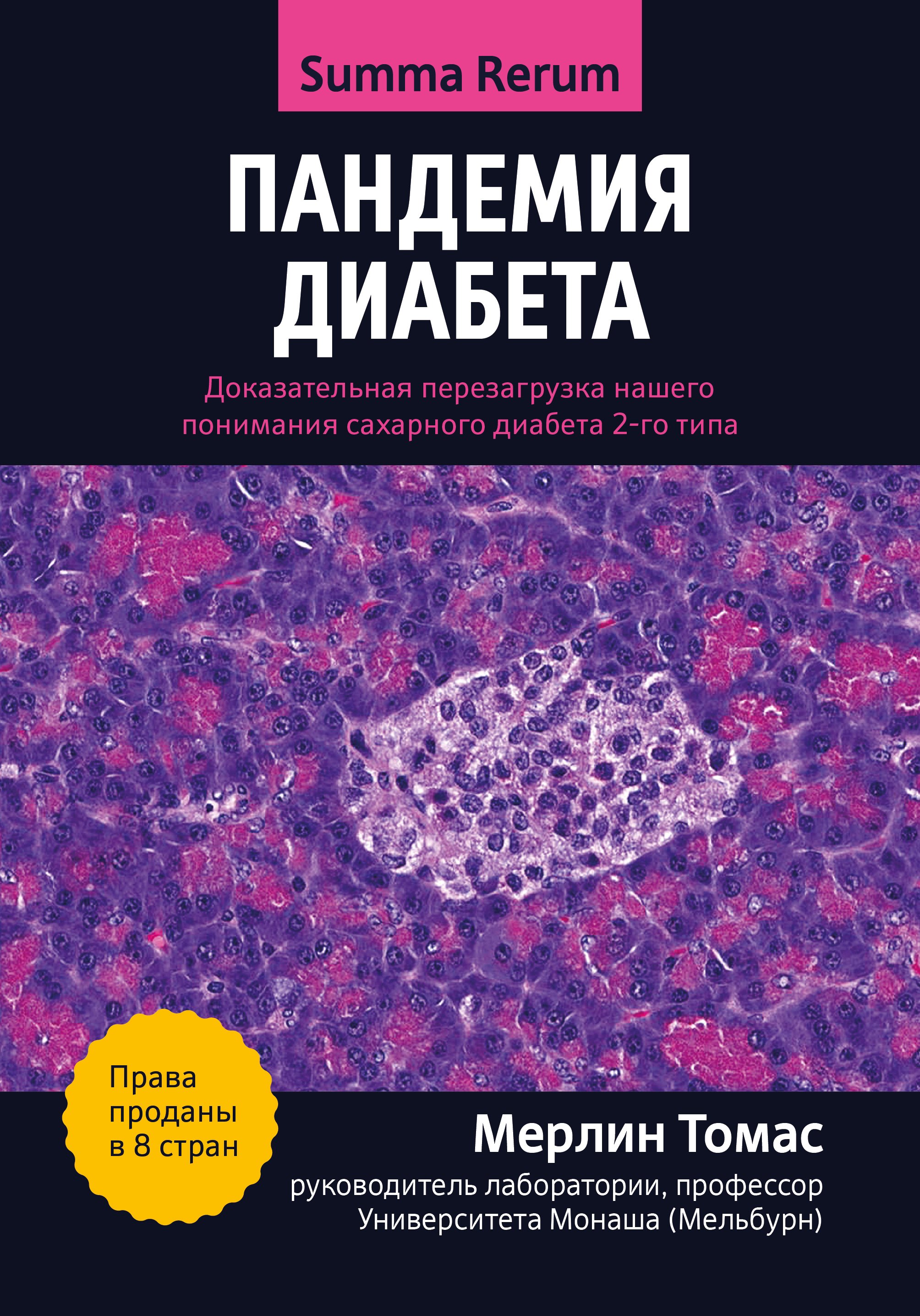 Пандемия диабета: доказательная перезагрузка нашего понимания сахарного диабета 2-го типа
Пандемия диабета: доказательная перезагрузка нашего понимания сахарного диабета 2-го типа