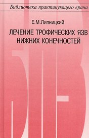 Лечение трофических язв нижних конечностей