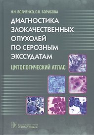 Диагностика злокачественных опухолей по серозным экссудатам.