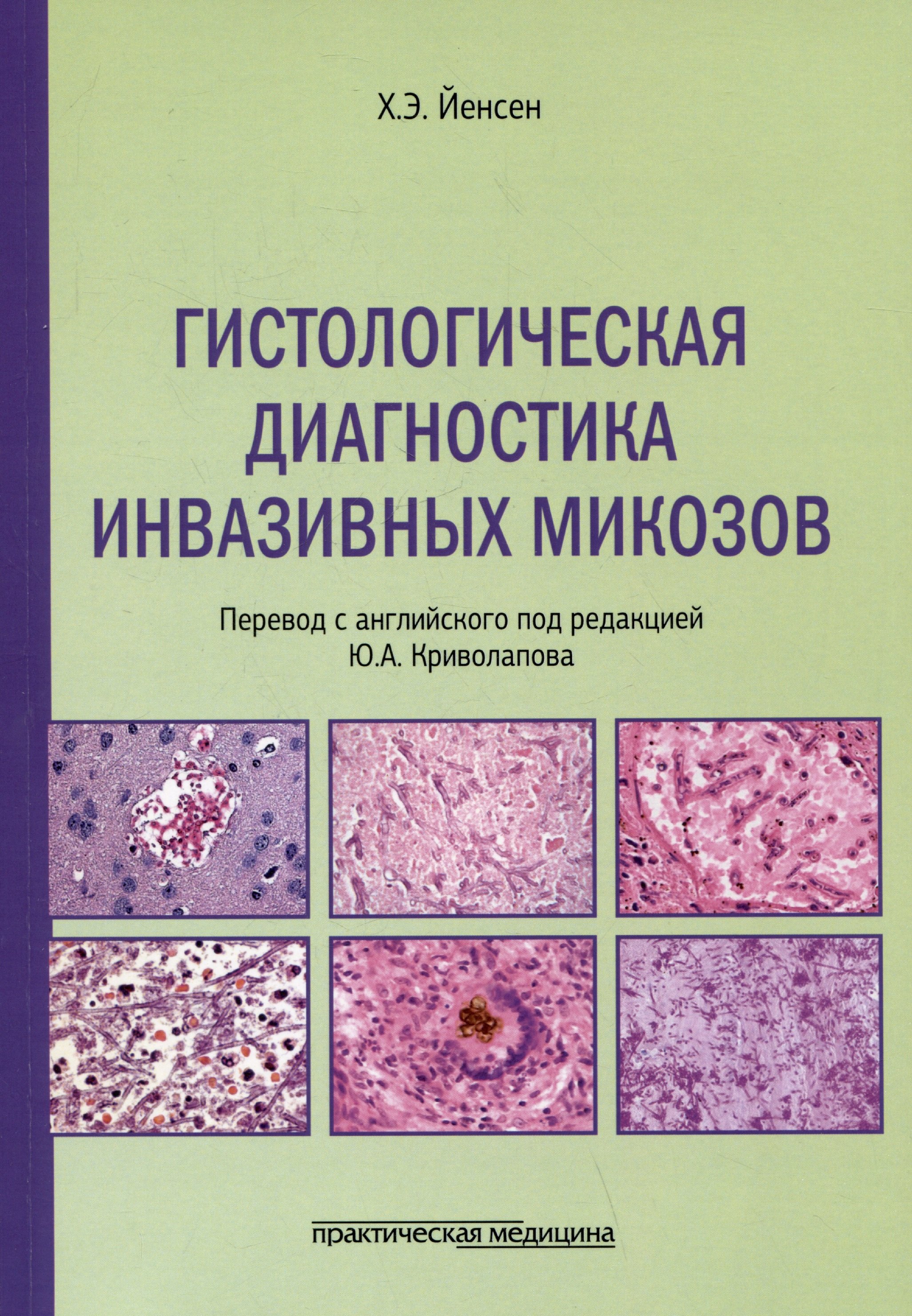 Гистологическая диагностика инвазивных микозов 
Гистологическая диагностика инвазивных микозов
