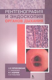 Рентгенография и эндоскопия органов дыхания
