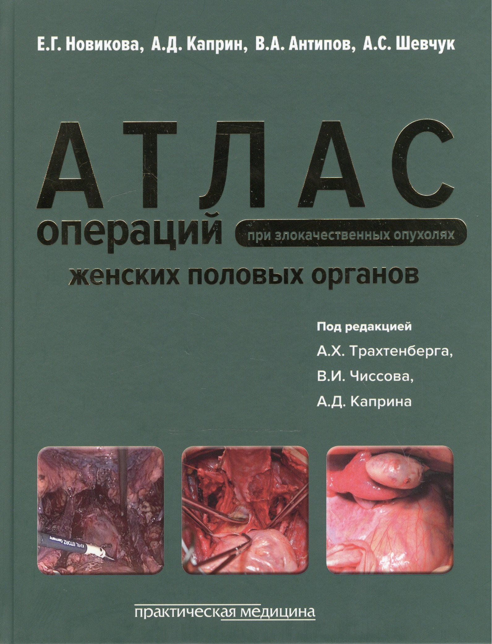 Атлас операций при злокачественных опухолях женских половых органов (Новикова)
Атлас операций при злокачественных опухолях женских половых органов (Новикова)
