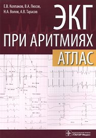 ЭКГ при аритмиях Атлас (+линейка электрокардиографическая) (м) Колпаков