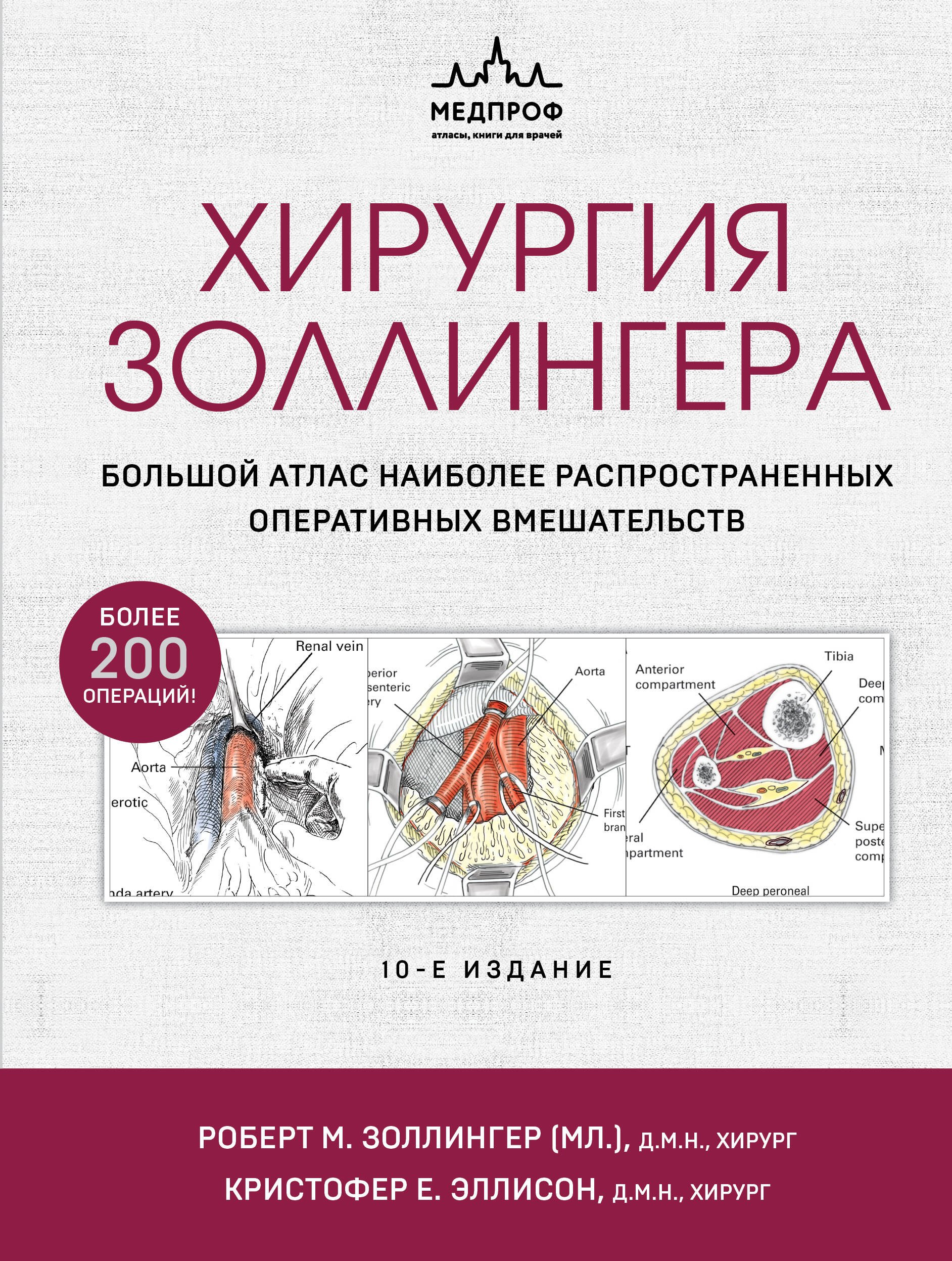 Хирургия Золлингера. Большой атлас наиболее распространенных оперативных вмешательств
Хирургия Золлингера. Большой атлас наиболее распространенных оперативных вмешательств