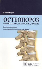 Остеопороз. Профилактика диагностика лечение
