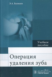 Операция удаления зуба.