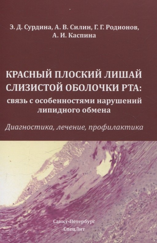 Красный плоский лишай слизистой оболочки рта: связь с особенностями нарушений липидного обмена
Красный плоский лишай слизистой оболочки рта: связь с особенностями нарушений липидного обмена