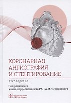 Коронарная ангиография и стентирование. Руководство