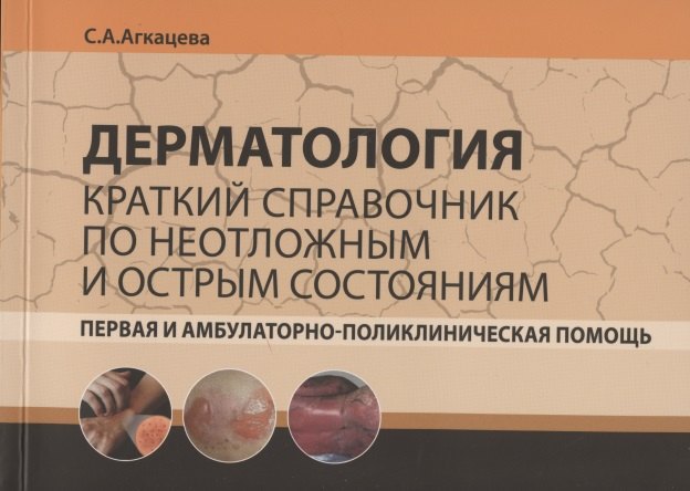 Дерматология. Краткий справочник по неотложным и острым состояниям. Первая и амбулаторно-поликлиническая помощь
Дерматология. Краткий справочник по неотложным и острым состояниям. Первая и амбулаторно-поликлиническая помощь