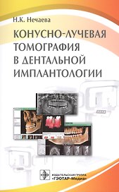 Конусно-лучевая томография в дентальной имплантологии
