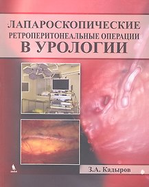 Лапароскопические ретроперитонеальные операции в урологии