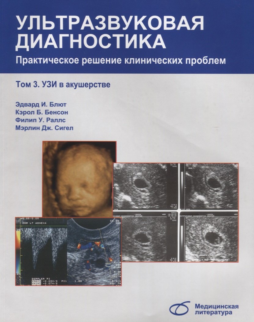 Ультразвуковая диагностика. Практическое решение клинических проблем, т. 3. УЗИ в акушерстве
Ультразвуковая диагностика. Практическое решение клинических проблем, т. 3. УЗИ в акушерстве
