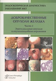 Доброкачественные опухоли желудка. Часть 1. Эпителиальные опухоли и опухолеподобные поражения. Учебно-методическое пособие