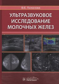 Ультразвуковое исследование молочных желез