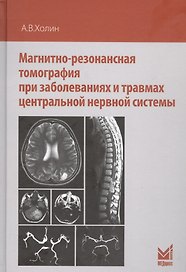 Магнитно-резонансная томография при заболеваниях и травмах центральной нервной системы