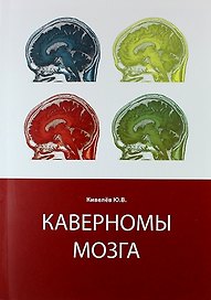 Каверномы мозга