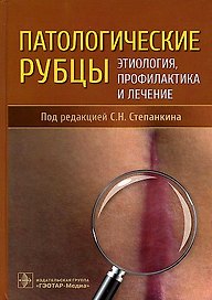 Патологические рубцы. Этиология, профилактика и лечение