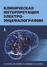 Клиническая интерпретация электроэнцефалографии