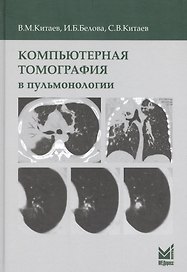 Компьютерная томография в пульмонологии