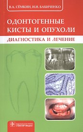 Одонтогенные кисты и опухоли. Диагностика и лечение
