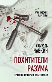 Похитители разума. Краткая история лоботомии