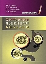 Хирургия язвенной болезни