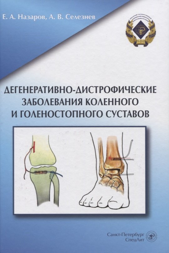 Дегенеративно-дистрофические заболевания коленного и голеностопного суставов
Дегенеративно-дистрофические заболевания коленного и голеностопного суставов