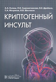 Криптогенный инсульт. Руководство