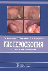 Гистероскопия : атлас и руководство. 2-е издание, дополненное и переработанное