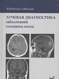 Лучевая диагностика заболеваний головного мозга