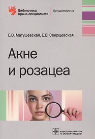 Акне и розацеа