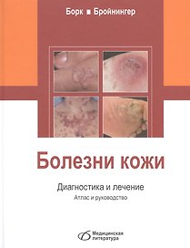 Болезни кожи. Диагностика и лечение