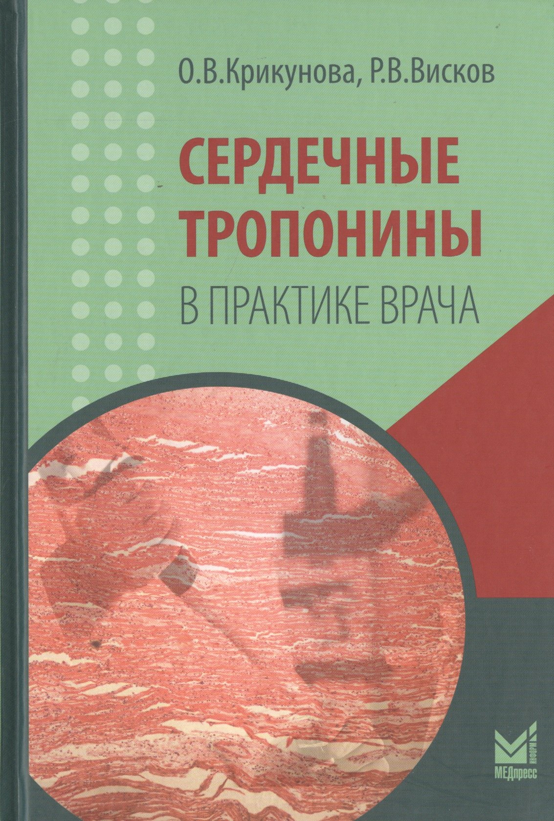 

Сердечные тропонины в практике врача