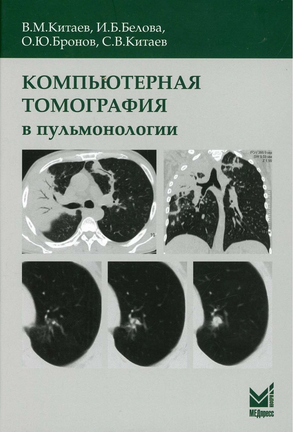Обложка книги «Компьютерная томография в пульмонологии»