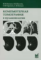 Компьютерная томография в пульмонологии