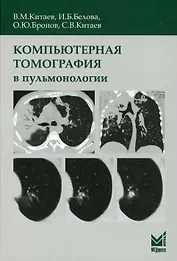 Компьютерная томография в пульмонологии