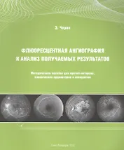 Флюоресцентная ангиография и анализ получаемых результатов: Методическое пособие для врачей-интернов, клинических ординаторов и аспирантов