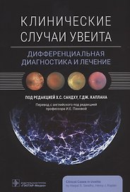 Клинические случаи увеита. Дифференциальная диагностика и лечение