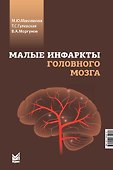 Малые инфаркты головного мозга - 0