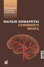 Малые инфаркты головного мозга