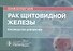 Рак щитовидной железы: руководство для врачей - 0